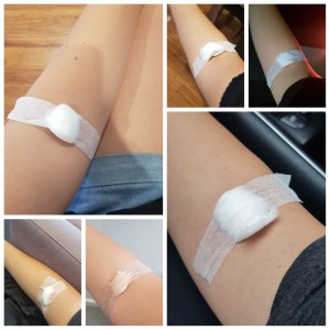 blood tests